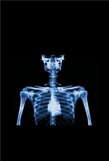 The X-Ray Scanner(͸)v4.0ͼ1