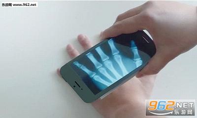 扫描人体骨头软件手机版|手机扫描骨头软件下